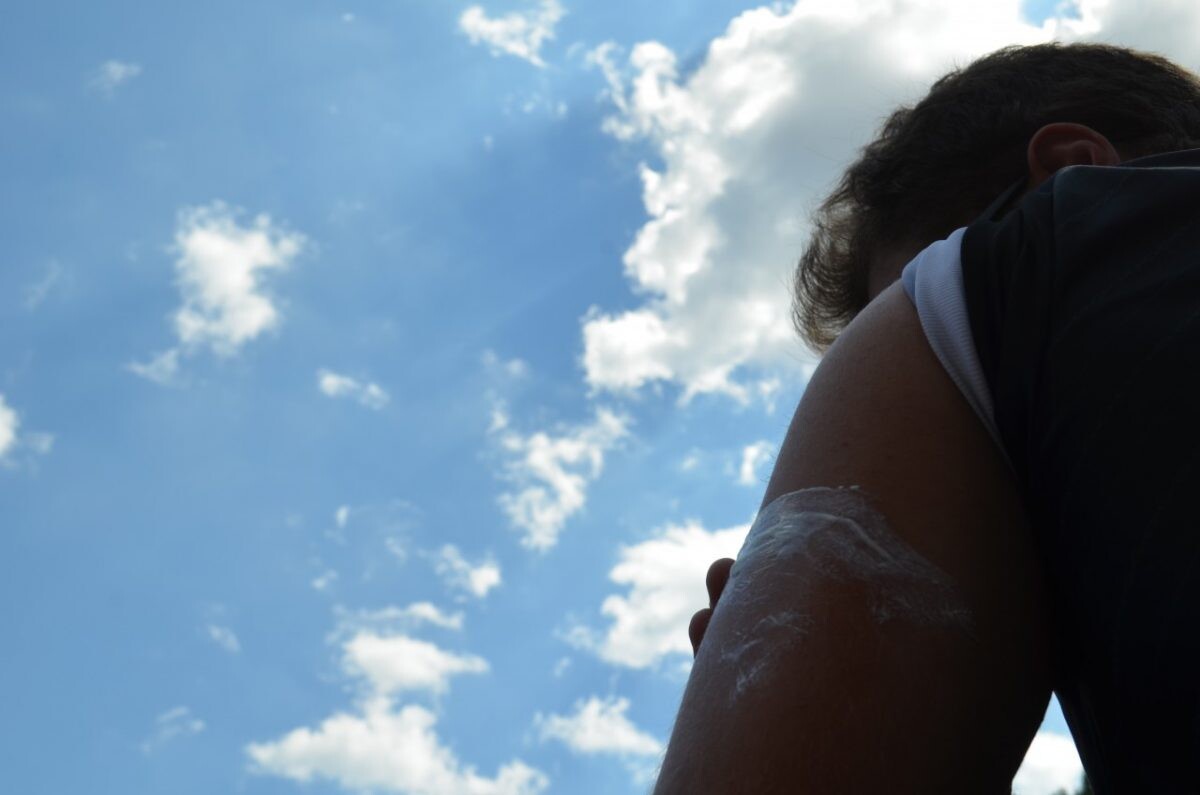 Associação endossa campanha de prevenção ao câncer de pele