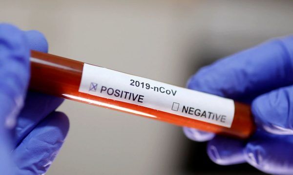 Brasil tem mais de 20,7 mil casos confirmados de covid-19