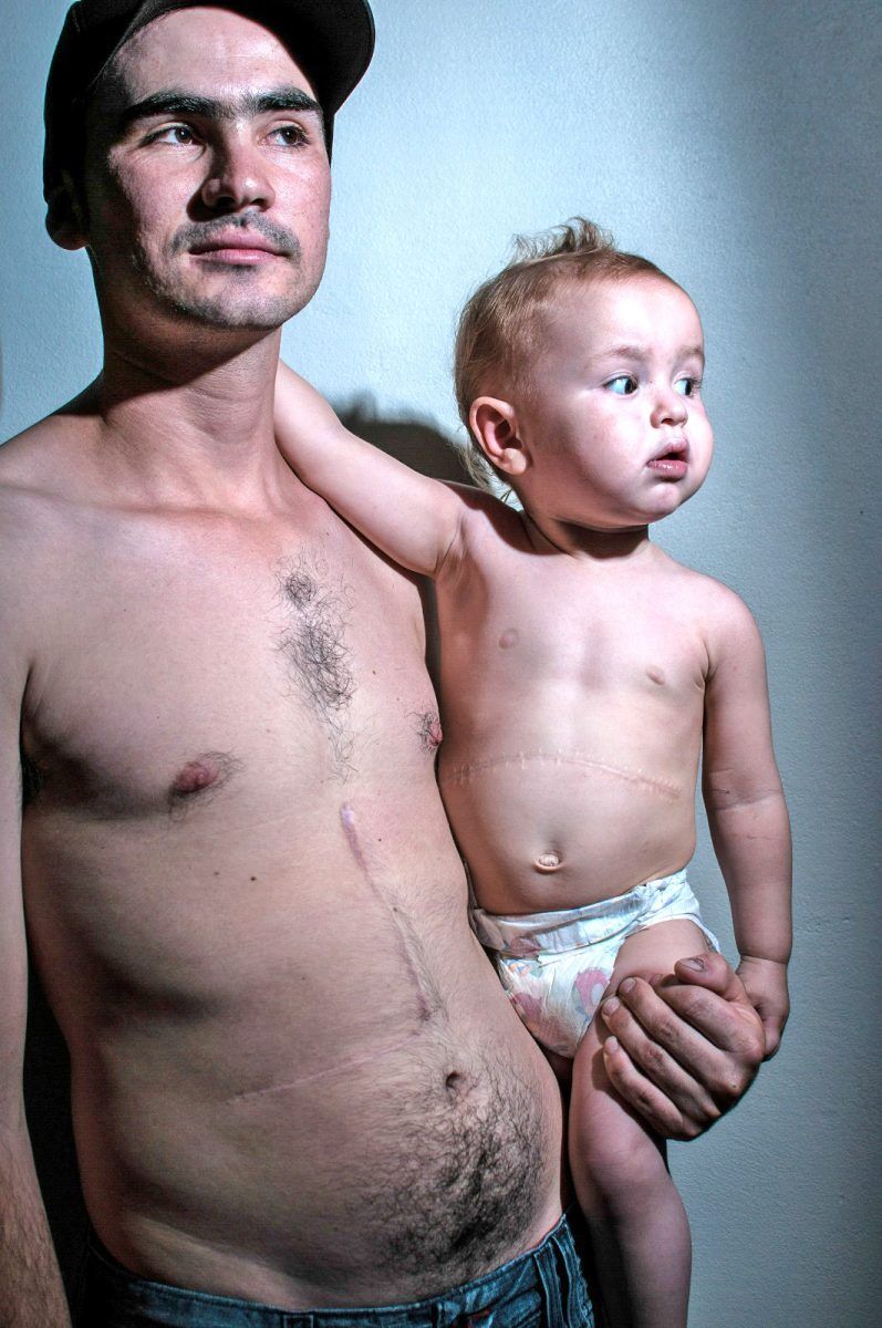 Festa marca os 10 anos do primeiro transplante em um bebê no estado
