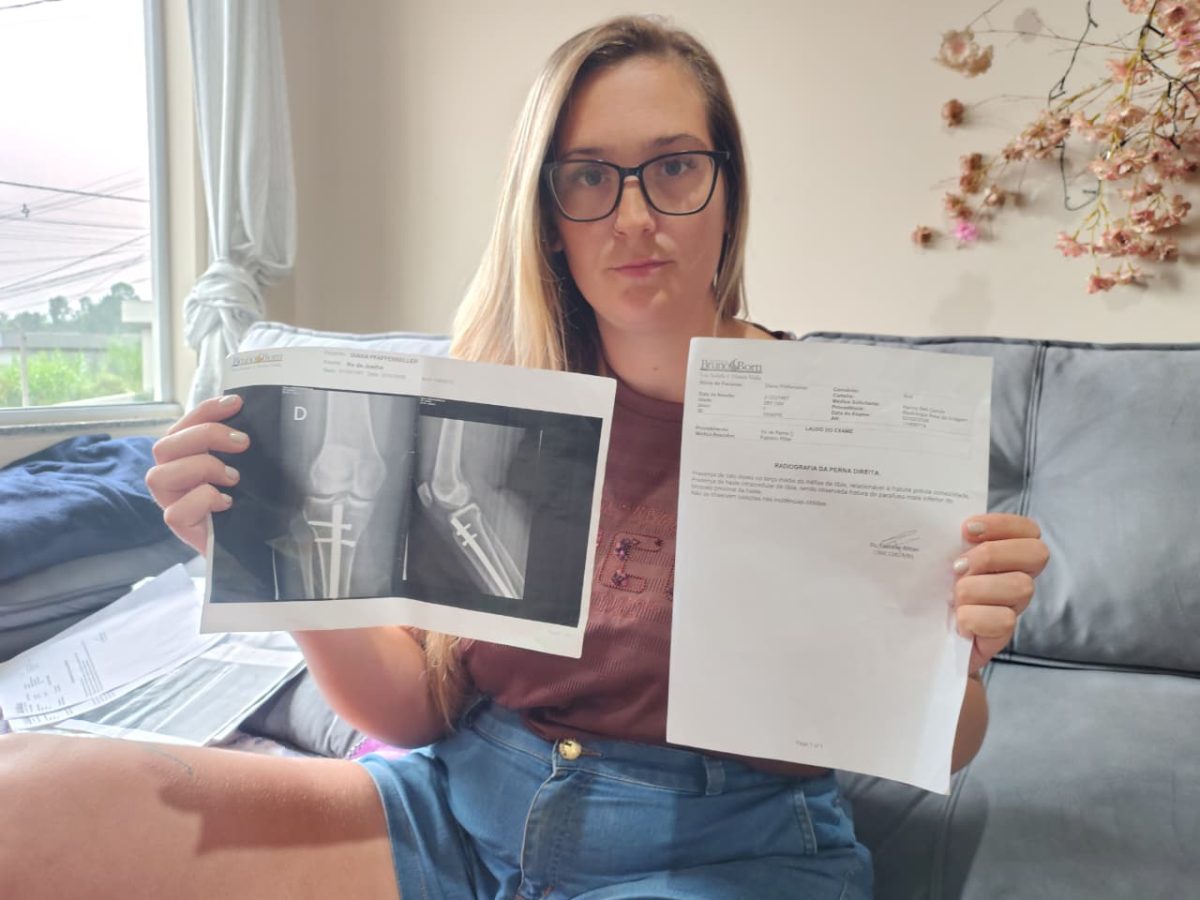 Mulher descobre parafuso quebrado na perna e aguarda consulta urgente pelo SUS